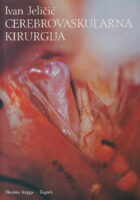 Cerebrovaskularna kirurgija